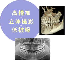 高精細・立体撮影・低被曝